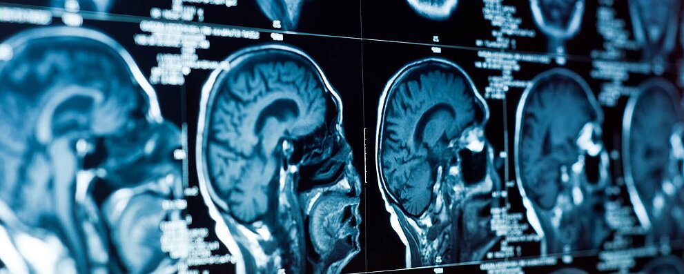 Nonsensitive Drives for Magnetic Resonance Tomography